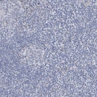 Immunohistochemical staining of human tonsil shows low expression as expected.