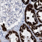 Immunohistochemical staining of human kidney using Anti-ALDH6A1 antibody HPA029073.