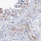 Immunohistochemical staining of human testis using Anti-ALDH6A1 antibody HPA029073.