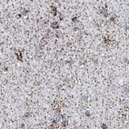 Immunohistochemical staining of human cerebral cortex using Anti-ALDH6A1 antibody HPA029073.