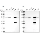 Western blot analysis using Anti-ALDH6A1 antibody HPA029073 (A) shows similar pattern to independent antibody HPA029074 (B).