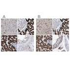 Immunohistochemical staining of human cerebral cortex, kidney, liver and testis using Anti-ALDH6A1 antibody HPA029074 (A) shows similar protein distribution across tissues to independent antibody HPA029072 (B).
