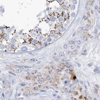 Immunohistochemical staining of human testis using Anti-ALDH6A1 antibody HPA029074.