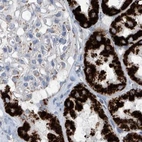 Immunohistochemical staining of human kidney using Anti-ALDH6A1 antibody HPA029074.
