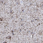 Immunohistochemical staining of human cerebral cortex using Anti-ALDH6A1 antibody HPA029074.