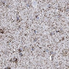 Immunohistochemical staining of human cerebral cortex using Anti-ALDH6A1 antibody HPA029074.