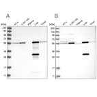 Western blot analysis using Anti-ALDH6A1 antibody HPA029074 (A) shows similar pattern to independent antibody HPA029073 (B).
