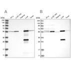 Western blot analysis using Anti-ALDH6A1 antibody HPA029074 (A) shows similar pattern to independent antibody HPA029073 (B).