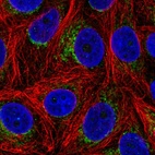Immunofluorescent staining of human cell line MCF7 shows localization to mitochondria.