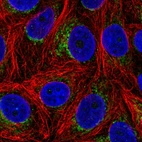 Immunofluorescent staining of human cell line MCF7 shows localization to mitochondria.