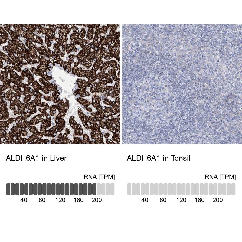 Anti-ALDH6A1 Antibody