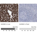 Anti-ALDH6A1 Antibody