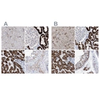 Immunohistochemical staining of human cerebral cortex, kidney, liver and testis using Anti-ALDH6A1 antibody HPA029075 (A) shows similar protein distribution across tissues to independent antibody HPA029072 (B).