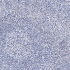 Immunohistochemical staining of human tonsil shows low expression as expected.