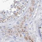 Immunohistochemical staining of human testis using Anti-ALDH6A1 antibody HPA029075.
