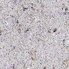 Immunohistochemical staining of human cerebral cortex using Anti-ALDH6A1 antibody HPA029075.