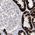Immunohistochemical staining of human kidney using Anti-ALDH6A1 antibody HPA029075.
