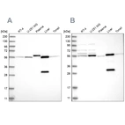 Western blot analysis using Anti-ALDH6A1 antibody HPA029075 (A) shows similar pattern to independent antibody HPA029073 (B).