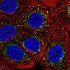 Immunofluorescent staining of human cell line MCF7 shows localization to mitochondria.