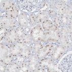 Anti-AP000322.53 Antibody