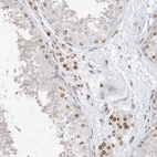 Anti-EIF5A2 Antibody