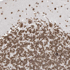 Anti-EIF5A2 Antibody