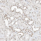 Immunohistochemical staining of human kidney shows moderate positivity in nuclear membrane in cells in tubules.