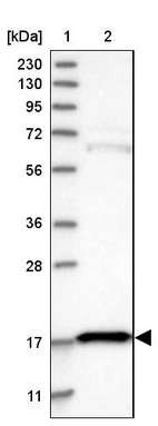 Lane 1: Marker [kDa] 230, 130, 95, 72, 56, 36, 28, 17, 11_br/_Lane 2: Human cell line RT-4