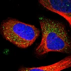 Immunofluorescent staining of human cell line U-2 OS shows localization to vesicles.
