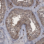 Immunohistochemical staining of human testis shows moderate cytoplasmic positivity in cells in seminiferous ducts.