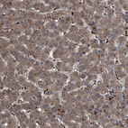 Immunohistochemical staining of human liver shows moderate cytoplasmic positivity in hepatocytes.