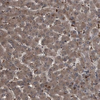 Immunohistochemical staining of human liver shows moderate cytoplasmic positivity in hepatocytes.