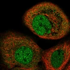 Immunofluorescent staining of human cell line A-431 shows localization to nucleoplasm & cytosol.