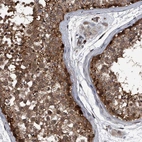 Immunohistochemical staining of human testis shows high expression.