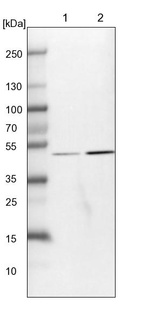 Lane 1: NIH-3T3 cell lysate (Mouse embryonic fibroblast cells)_br/_Lane 2: NBT-II cell lysate (Rat Wistar bladder tumour cells)