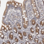 Immunohistochemical staining of human duodenum shows moderate cytoplasmic positivity in glandular cells.