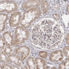 Immunohistochemical staining of human kidney shows moderate cytoplasmic positivity in cells in tubules.