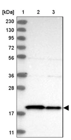 Lane 1: Marker [kDa] 230, 130, 95, 72, 56, 36, 28, 17, 11_br/_Lane 2: Human cell line RT-4_br/_Lane 3: Human cell line U-251MG sp
