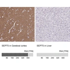 Anti-SEPT5 Antibody
