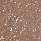 Immunohistochemical staining of human cerebral cortex shows moderate cytoplasmic positivity in neuropil.