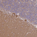 Immunohistochemical staining of human cerebellum shows moderate cytoplasmic positivity in Purkinje cells.