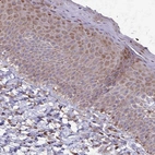 Immunohistochemical staining of human skin shows moderate cytoplasmic positivity in squamous epithelial cells.