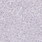 Immunohistochemical staining of human liver shows negative cytoplasmic positivity in hepatocytes as expected.