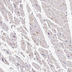 Immunohistochemical staining of human heart muscle shows low expression as expected.