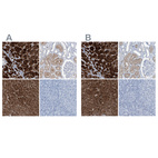 Immunohistochemical staining of human adrenal gland, kidney, liver and tonsil using Anti-RGN antibody HPA029102 (A) shows similar protein distribution across tissues to independent antibody HPA029103 (B).