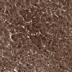 Immunohistochemical staining of human liver shows strong positivity in hepatocytes.
