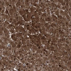 Immunohistochemical staining of human liver shows strong positivity in hepatocytes.