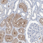 Immunohistochemical staining of human kidney shows moderate cytoplasmic positivity in cells in tubules.