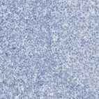 Immunohistochemical staining of human tonsil shows no positivity in non-germinal center cells as expected.