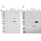 Western blot analysis using Anti-RGN antibody HPA029102 (A) shows similar pattern to independent antibody HPA029103 (B).